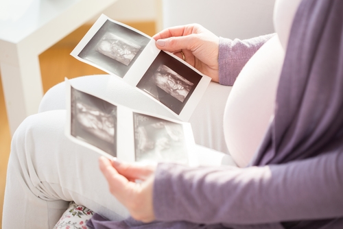 tanda hasil USG bayi laki-laki dan perempuan - Ibudanbalita