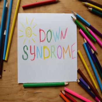 Down Syndrome: Ciri-ciri, Penyebab, Diagnosis, dan Pengobatan